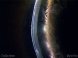 Platinum EyeRes System Images